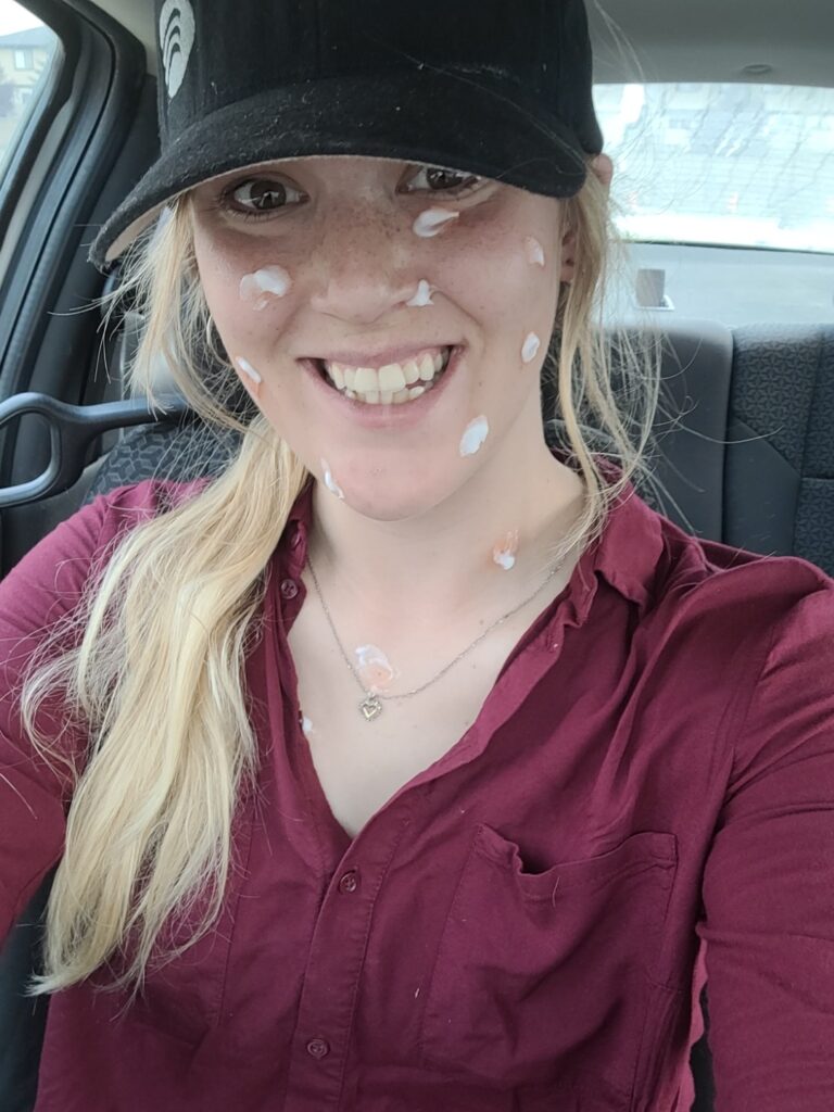 Wasp, wasps everywhere. Wasps attacked fiera Biologicals field staff, like this smiling employee who's face is splattered with calamine lotion covering a dozen or more wasp stings. 